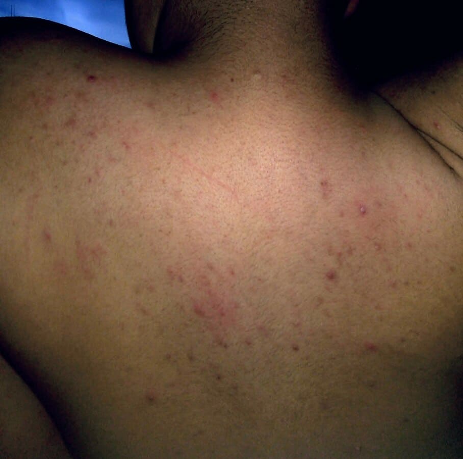 Red Spots