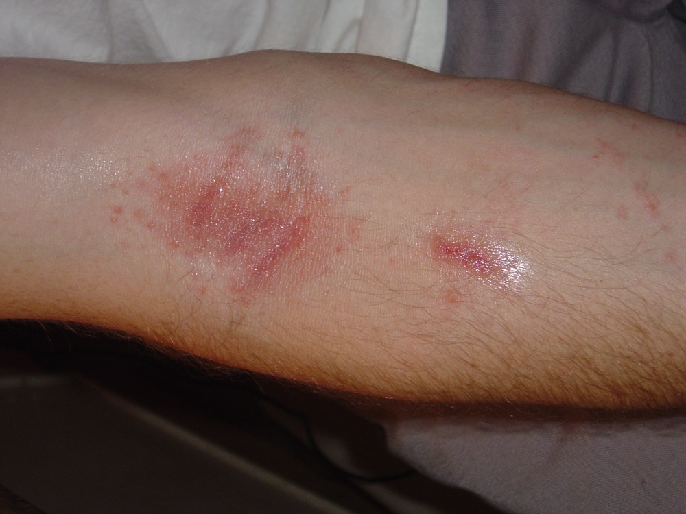 Red Spots