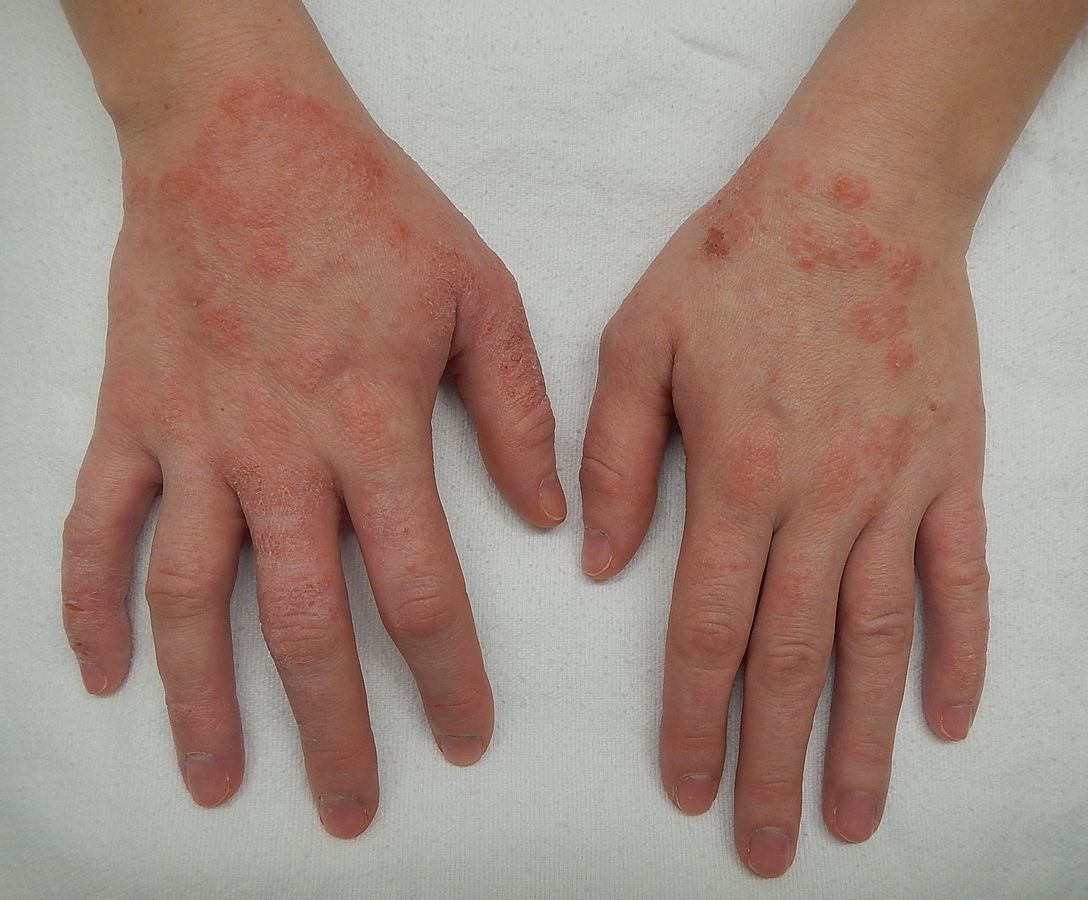 Red Spots